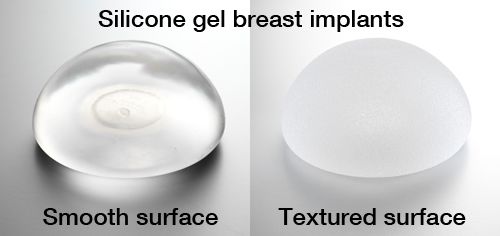 protesi texturizzate vs lisce